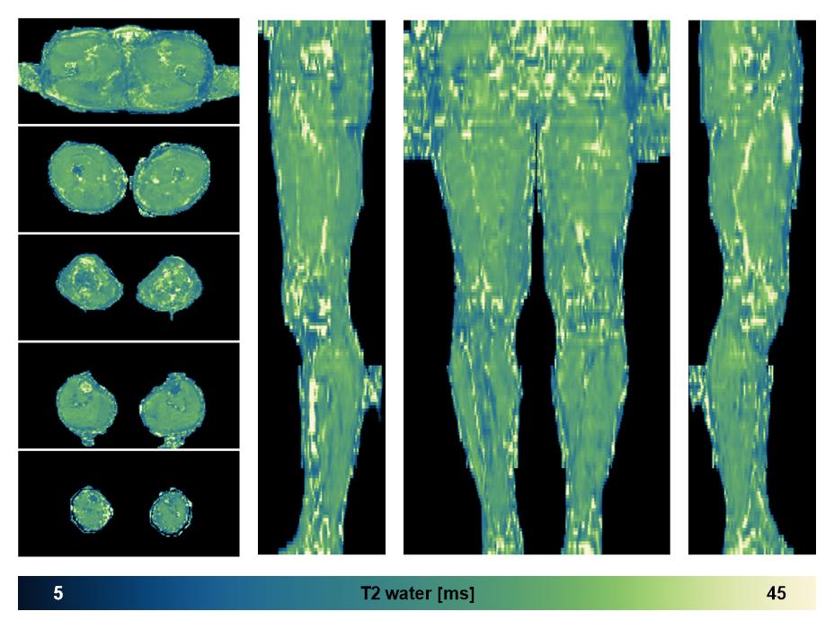 The water only T2 relaxation time of the lower extremity obtained from multi echo spin echo t2 mapping with EPG based reconstruction.